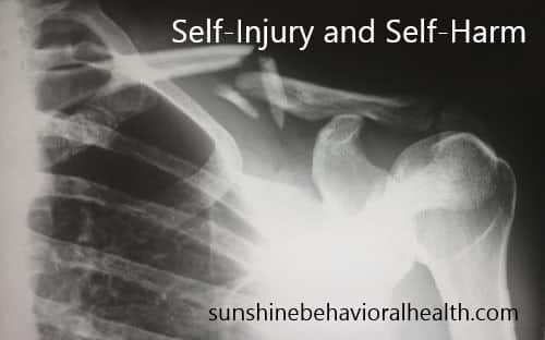 Self-injury-image